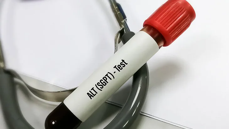 ALT NEDİR? KAN TAHLİLİ ALT YÜKSEKLİĞİ NE ANLAMA GELİR, NASIL DÜŞER?