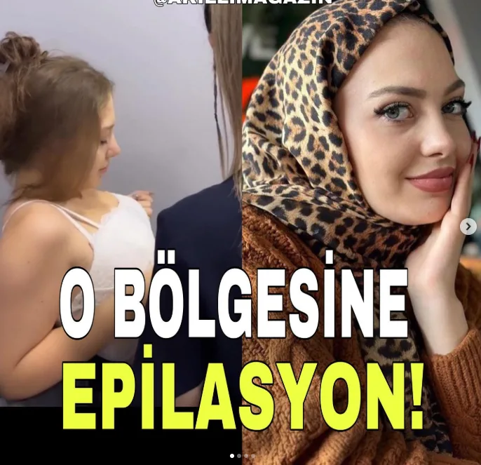 Fenomen Esra Rabia Ünal Gündemde! Paylaştığı Epilasyon Görüntüleri Tepki Çekti